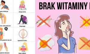 Objawy niedoboru wit D – Jak rozpoznać i uniknąć groźnych skutków