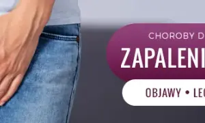 Zapalenie pęcherza: do ginekologa czy internisty? Kto pomoże szybciej?