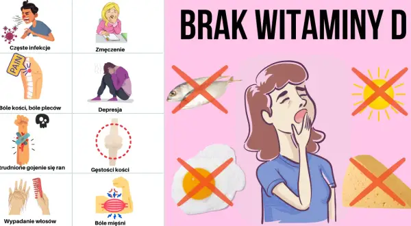 Objawy niedoboru wit D – Jak rozpoznać i uniknąć groźnych skutków